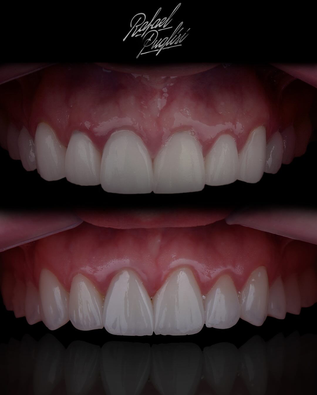 Dentes superiores e retratos comparativos. Imagem integral do registro.