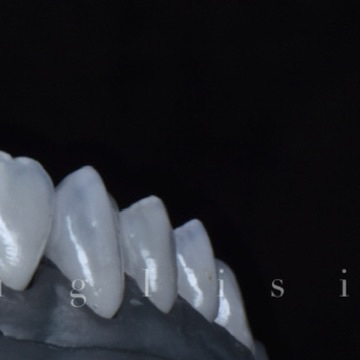 Estudo cerâmico · ângulo lateral direito Estudo de peças cerâmicas odontológicas pelo ângulo lateral direito