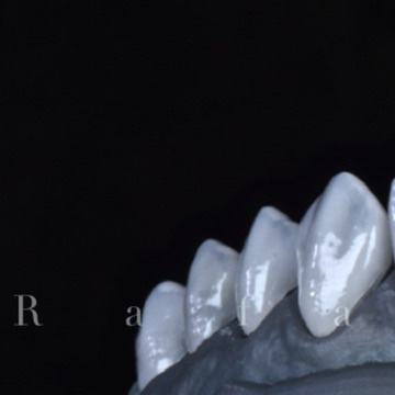 Estudo cerâmico · ângulo lateral esquerdo Estudo de peças cerâmicas odontológicas pelo ângulo lateral esquerdo