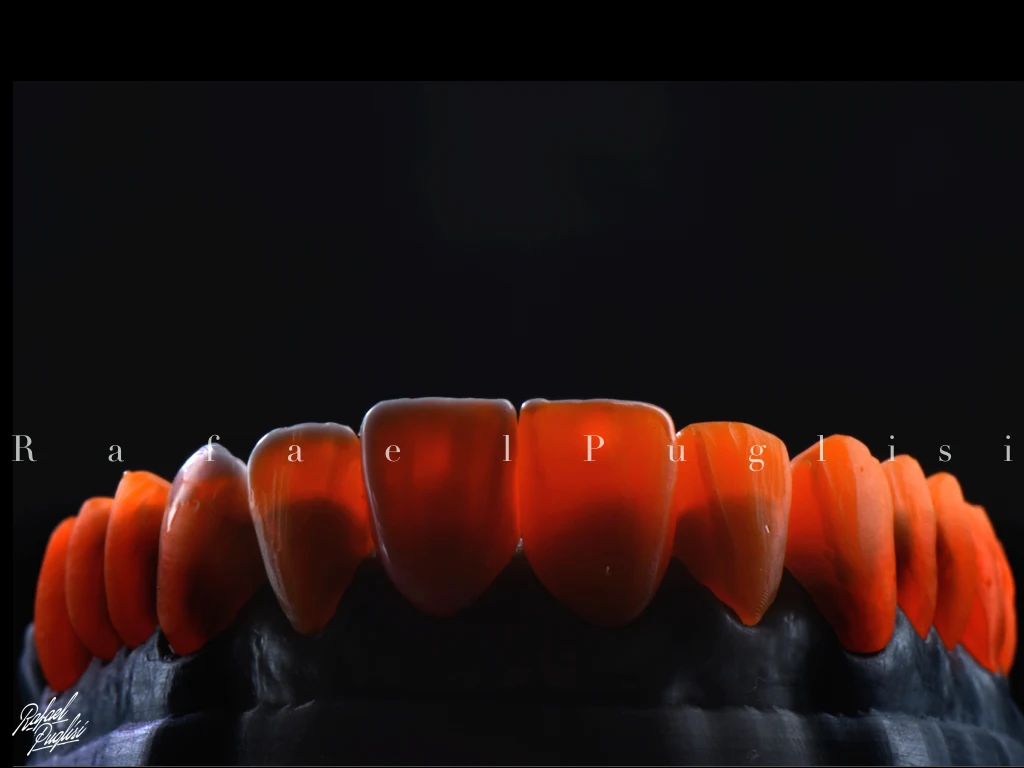 Fotografia autoral de Rafa Puglisi com cerâmicas odontológicas iluminadas por trás