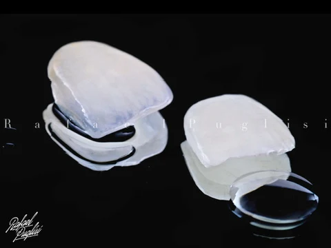 Fotografia autoral de Rafa Puglisi com lentes odontológicas e gotas sobre fundo preto