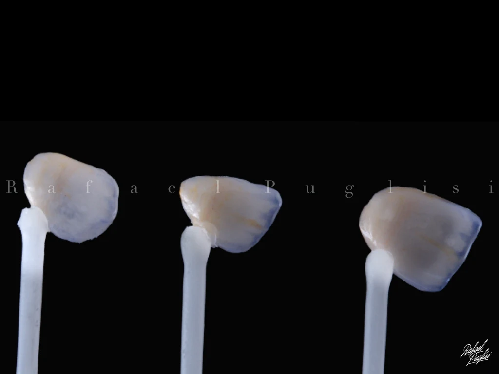 Fotografia autoral de Rafa Puglisi com três lentes odontológicas apoiadas em suportes