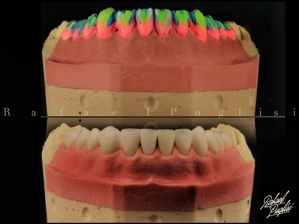 Fotografia autoral de Rafa Puglisi com modelo odontológico marcado por cores