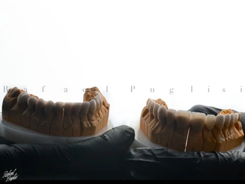 Fotografia autoral de Rafa Puglisi com modelos odontológicos sobre luvas e luz branca