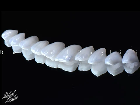 Fotografia autoral de Rafa Puglisi com uma sequência de lentes odontológicas